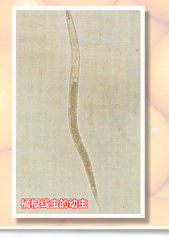 TylenchulusSemipenetrans-02